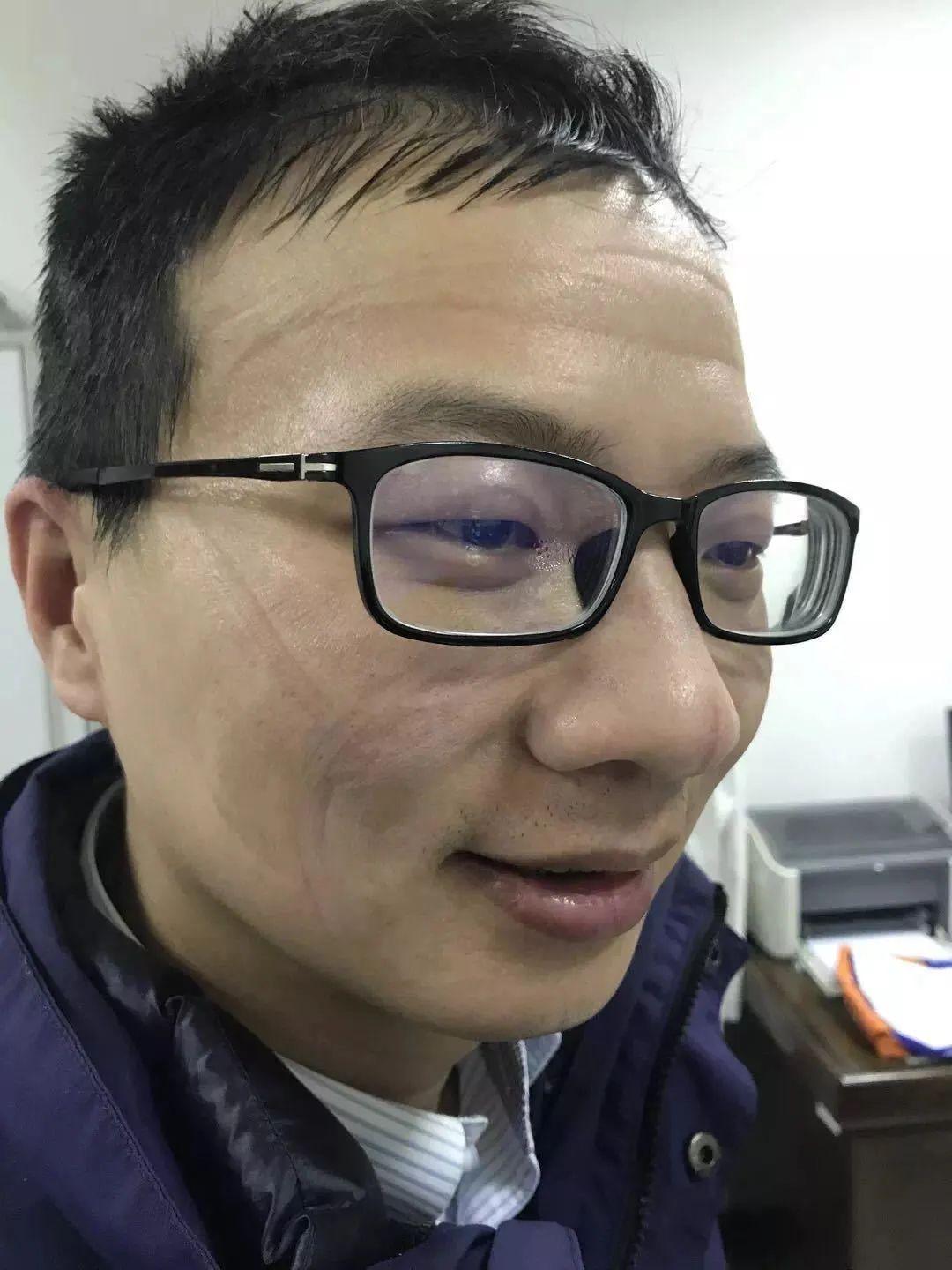 社区盾赛程吃紧；多特蒙德赛前完成体检；态度坚定；医务组通报恢复